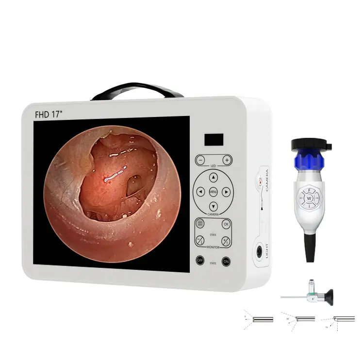 17 Inch HD Video Otoscope ENT  - Medical Lab Images ulasan dan harga