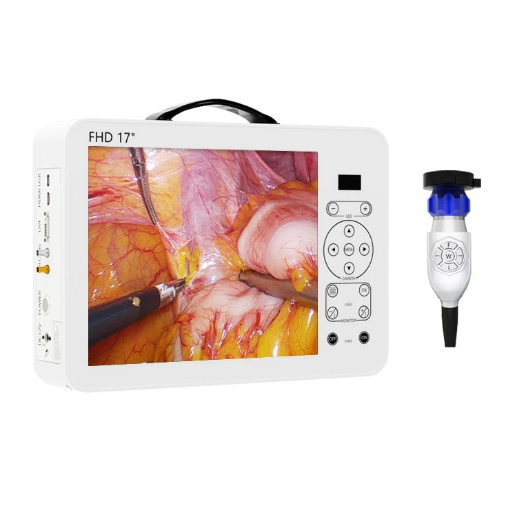 17 Inch HD Video Otoscope ENT  - Medical Lab Images ulasan dan harga